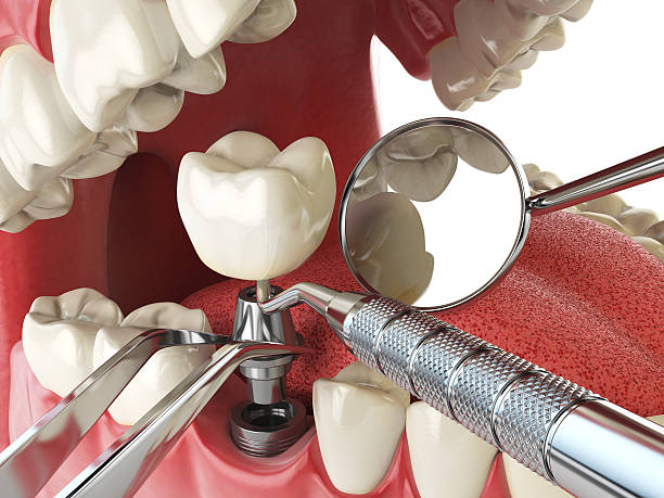 Best Emergency Dental Extractions in Thorp, WI